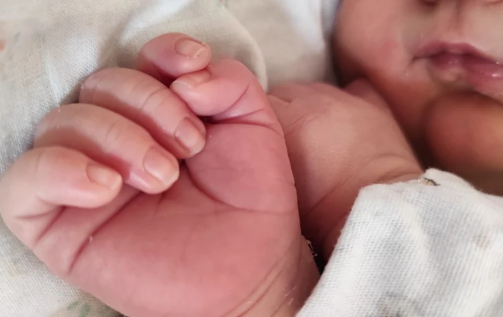 В Калужской области почти вдвое сократилось число рождений детей с синдромом Дауна