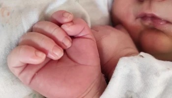 В Калужской области почти вдвое сократилось число рождений детей с синдромом Дауна